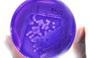 Multiresistente erreger blog inko versand
